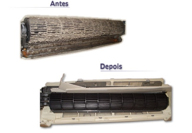 Tríade aparelho antes e depois