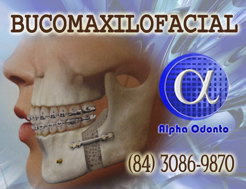 BUCOMAXILOFACIAL CIRURGIA ORTOGNÁTICA - (84) 3086-9870