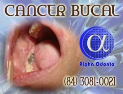 PerÍcia clÍnica com biÓpsia para detecÇÃo de cÂncer bucal - (84) 3086-9870