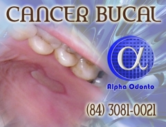 Percia clnica com bipsia para deteco de cncer bucal - (84) 3086-9870