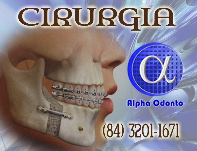 CIRURGIA ORTOGNÁTICA - (84) 3086-9870