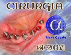 Cirurgia de implante dentrio - (84) 3086-9870