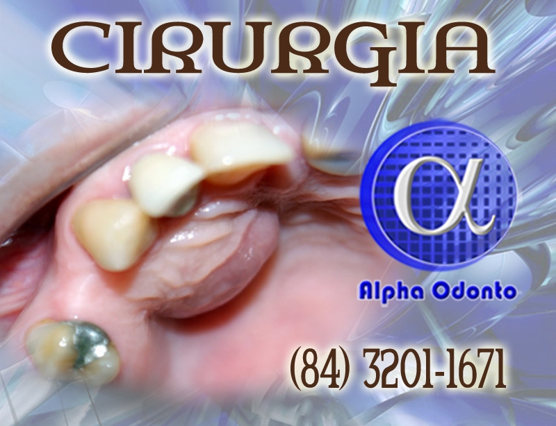 CIRURGIA DE ABSCESSO PALATINO - (84) 3086-9870