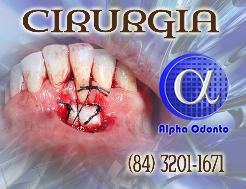 CIRURGIA DE ENXERTO SSEO - (84) 3086-9870