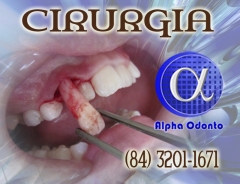 Cirurgia de dente supra numerrio - (84) 3086-9870