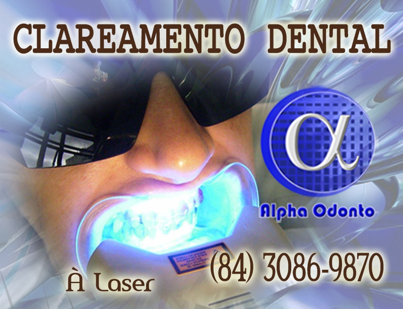 CLAREAMENTO TOTAL DENTAL À LASER - (84) 3086-9870