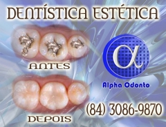 Dentstica esttica dentes perfeitos - (84) 3086-9870