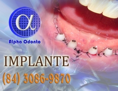 Implante dentrio inferior total - (84) 3086-9870