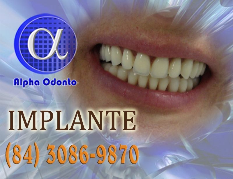 IMPLANTE DENTÁRIO TOTAL - (84) 3086-9870