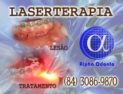 Laserterapia ortodntica - (84) 3086-9870