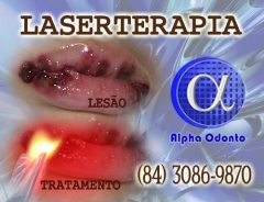 Laserterapia para mucosite - (84) 3086-9870