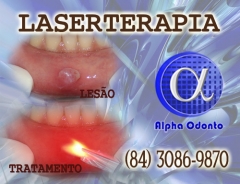 Laserterapia para leses labiais - (84) 3086-9870