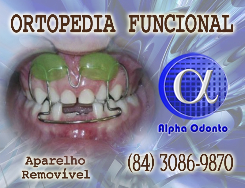 ORTOPEDIA FACIAL - (84) 3086-9870 - APARELHO ORTOPÉDICO