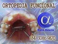 Ortopedia facial - (84) 3086-9870 - aparelho ortopdico