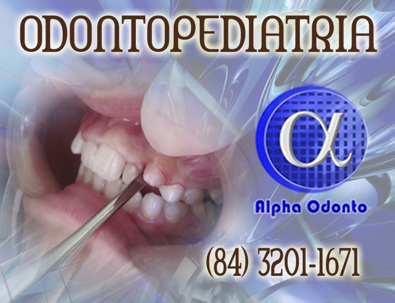 ODONTOPEDIATRIA - CIRURGIA ORAL PEDITRICA - (84) 3086-9870 - TRAGA SEUS FILHOS PARA A ALPHA ODONTO!