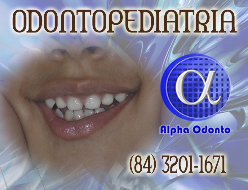 ODONTOPEDIATRIA ESPECIALIZADA - (84) 3086-9870 - TRAGA SEUS FILHOS PARA A ALPHA ODONTO!