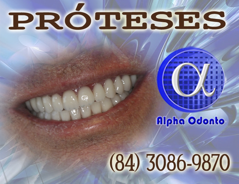 PRÓTESES DENTÁRIAS - TOTAIS ESTÉTICAS - (84) 3086-9870