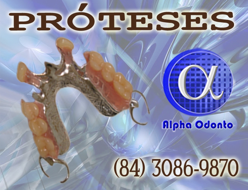 PRÓTESES DENTÁRIAS - PARCIAIS ESTÉTICAS - (84) 3086-9870