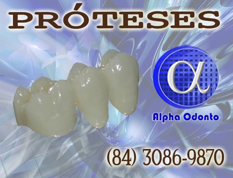 PRÓTESES DENTÁRIAS - COROAS ESTÉTICAS - (84) 3086-9870