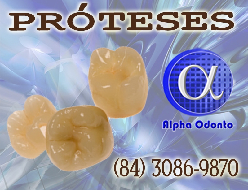 PRÓTESES DENTÁRIAS - COROAS ESTÉTICAS - (84) 3086-9870