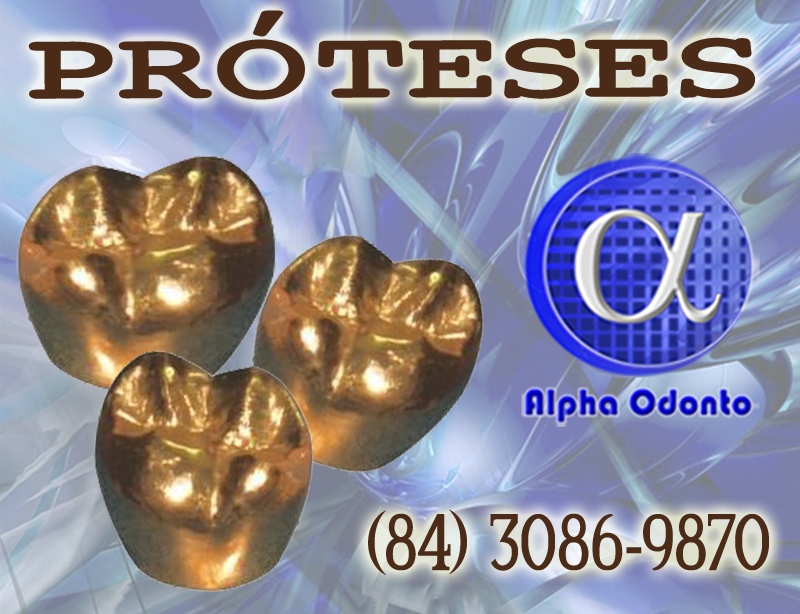 PRÓTESES DENTÁRIAS - COROAS METÁLICAS - (84) 3086-9870