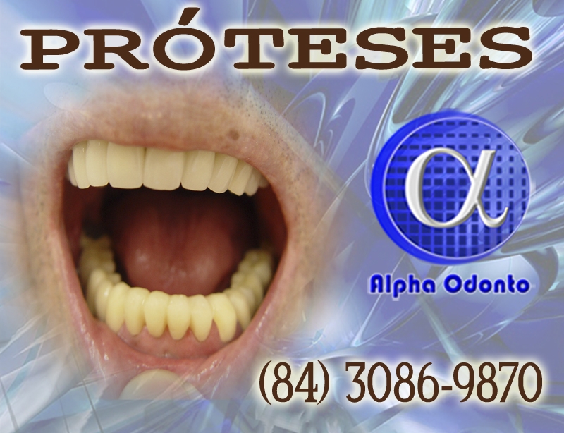 PRÓTESES DENTÁRIAS - TOTAIS ESTÉTICAS - (84) 3086-9870