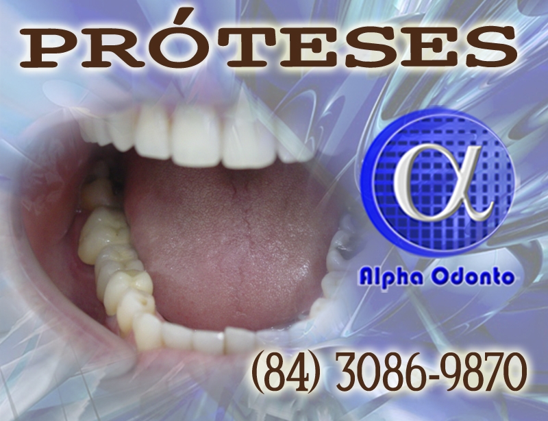 PRÓTESES DENTÁRIAS - PARCIAIS ESTÉTICAS - (84) 3086-9870