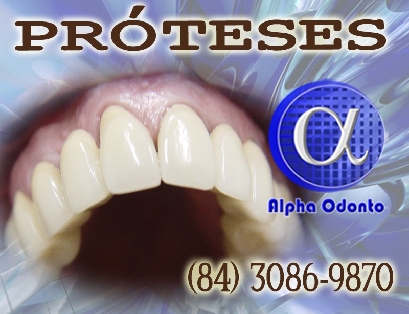 PRÓTESES DENTÁRIAS - TOTAIS E PARCIAIS ESTÉTICAS - (84) 3086-9870