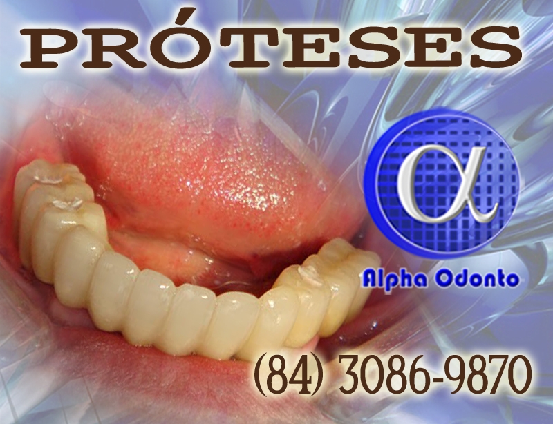 PRÓTESES DENTÁRIAS - TOTAIS E PARCIAIS ESTÉTICAS - (84) 3086-9870