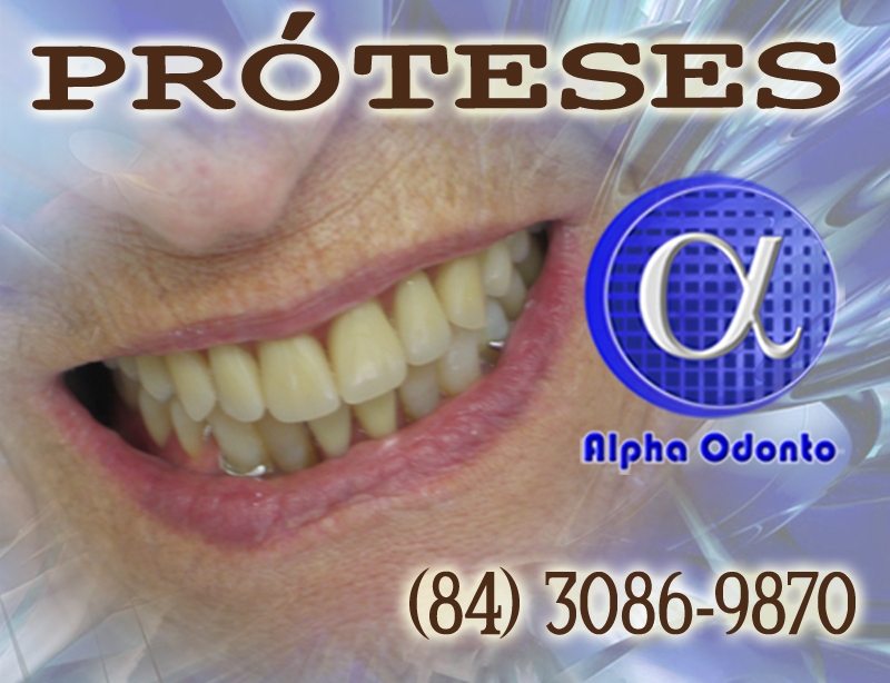 PRÓTESES DENTÁRIAS - TOTAIS E PARCIAIS ESTÉTICAS - (84) 3086-9870