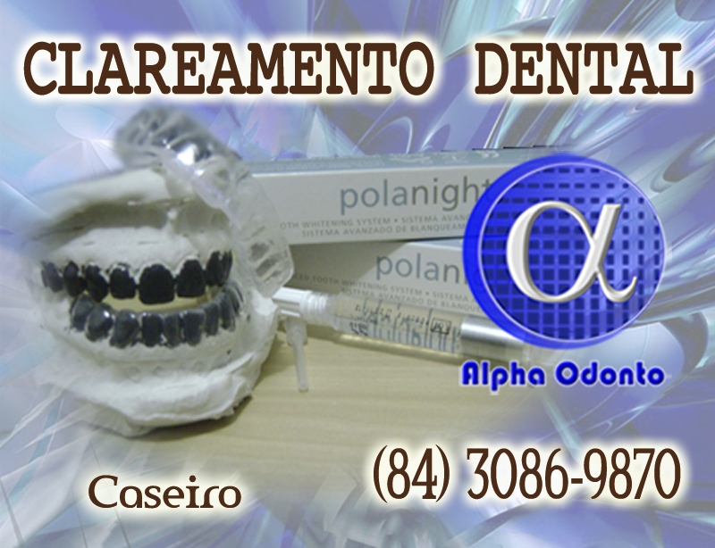CLAREAMENTO DENTAL CASEIRO - (84) 3086-9870