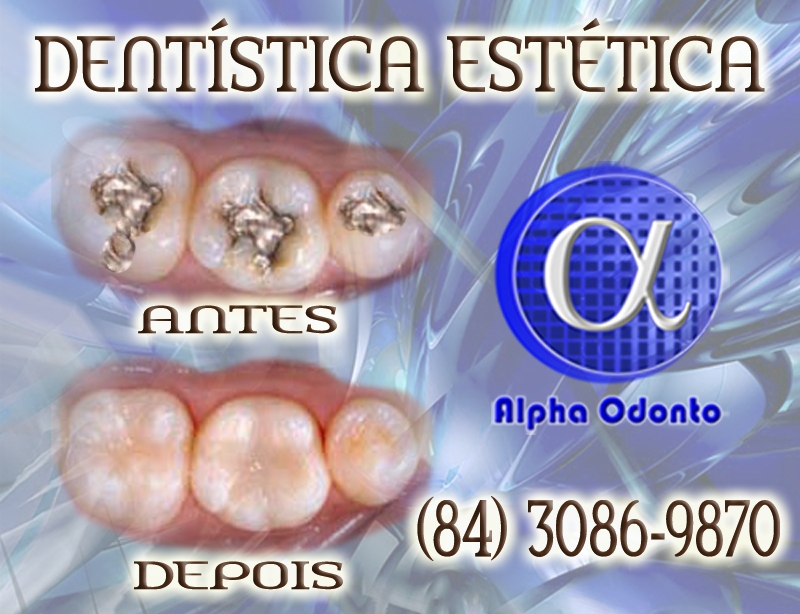DENTSTICA ESTTICA, PERFEIO EM RESTAURAO DENTRIA - (84) 3086-9870