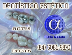 DentÍstica estÉtica, perfeiÇÃo em restauraÇÃo dentÁria - (84) 3086-9870
