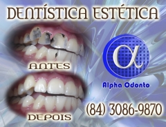 DentÍstica estÉtica, perfeiÇÃo em restauraÇÃo dentÁria - (84) 3086-9870