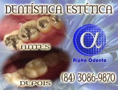 Dentística estética, perfeiÇÃo em restauraÇÃo dentária - (84) 3086-9870