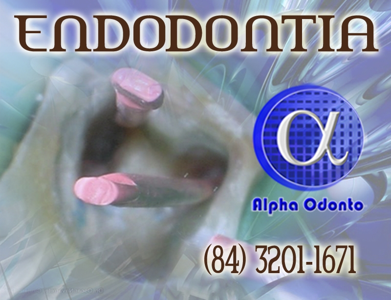 TRATAMENTO DE CANAL EM MOLAR - (84) 3086-9870