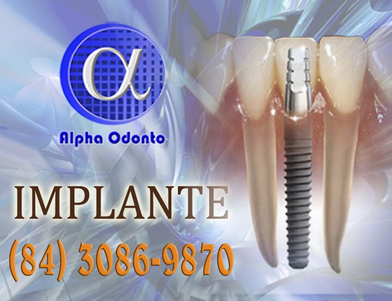 IMPLANTE DENTÁRIO ESTÉTICO - (84) 3086-9870