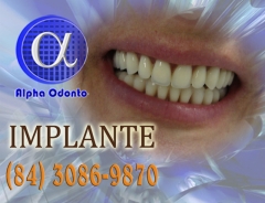 Implante dentário estético - (84) 3086-9870