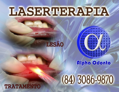 LASERTERAPIA ORAL - (84) 3086-9870