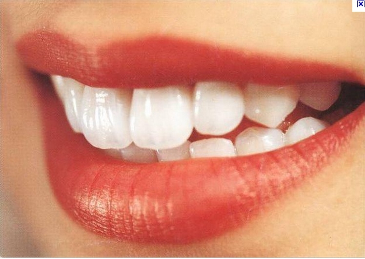 Clnica Dentria Implante RJ