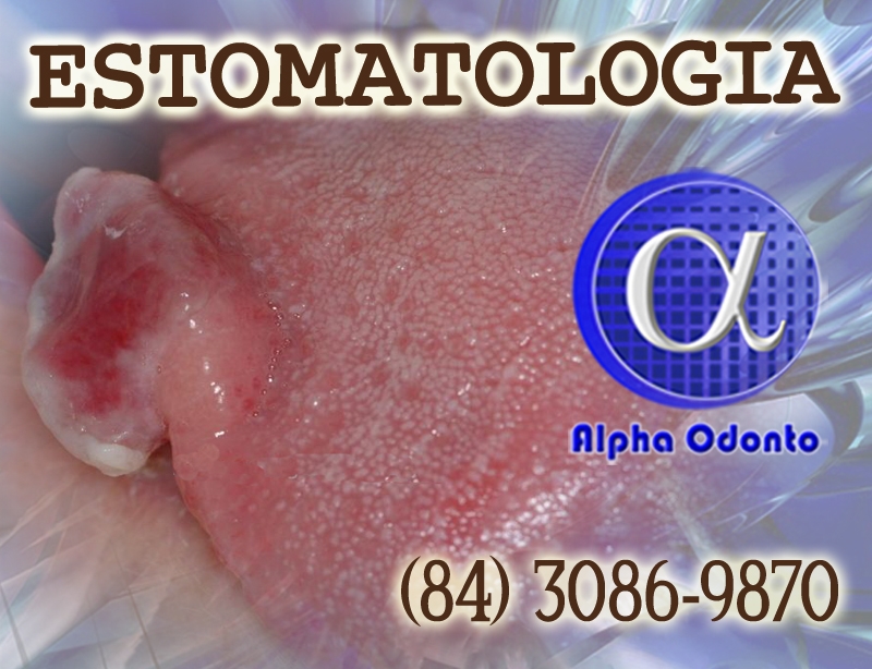 ESTOMATOLOGIA ESPECIALIZADA - (84) 3086-9870