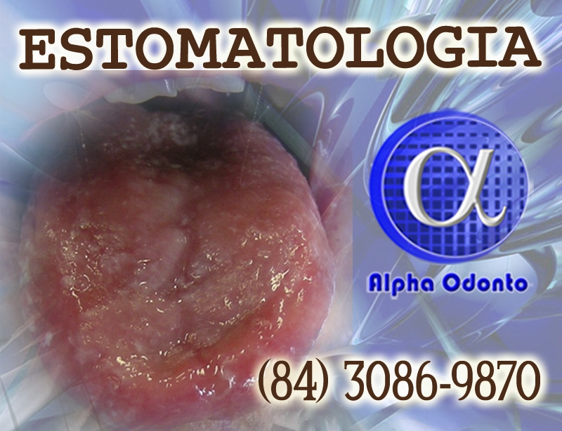 ESTOMATOLOGIA ESPECIALIZADA - (84) 3086-9870