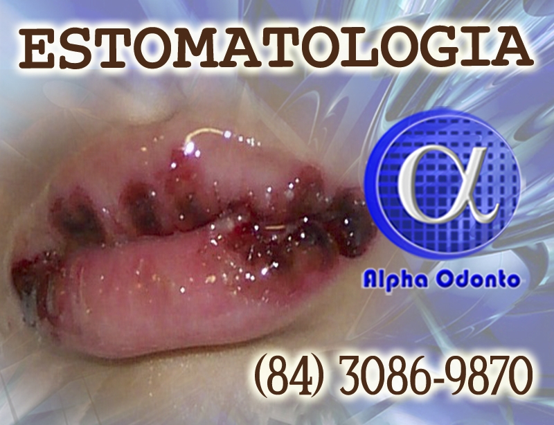 ESTOMATOLOGIA ESPECIALIZADA - (84) 3086-9870