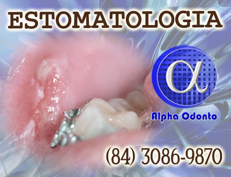 ESTOMATOLOGIA ESPECIALIZADA - (84) 3086-9870