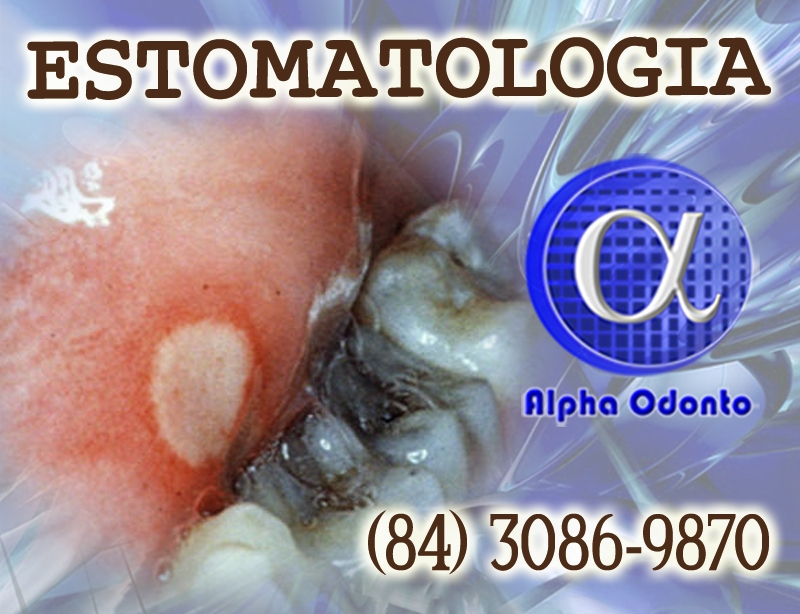 ESTOMATOLOGIA ESPECIALIZADA - (84) 3086-9870