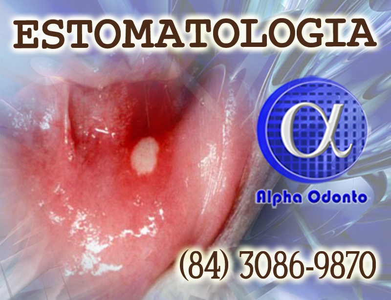 ESTOMATOLOGIA ESPECIALIZADA - (84) 3086-9870