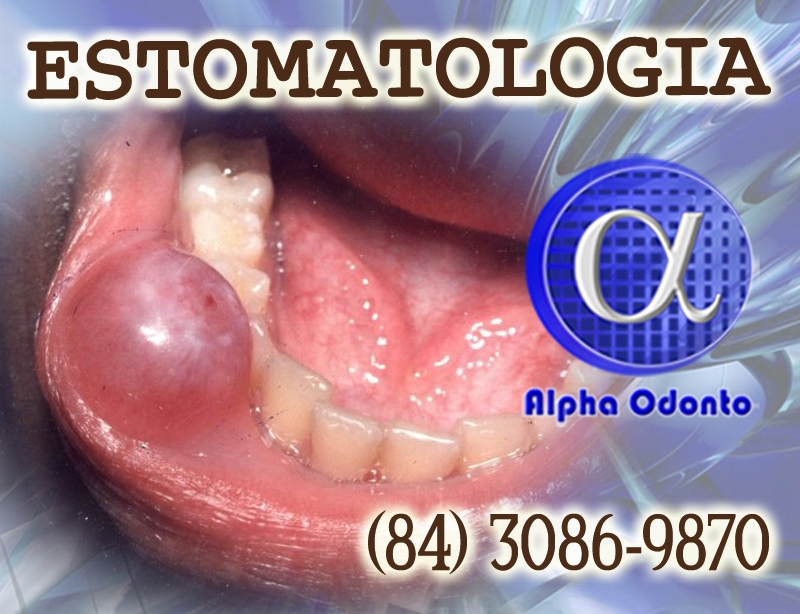 ESTOMATOLOGIA ESPECIALIZADA - (84) 3086-9870