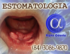 Estomatologia especializada - (84) 3086-9870