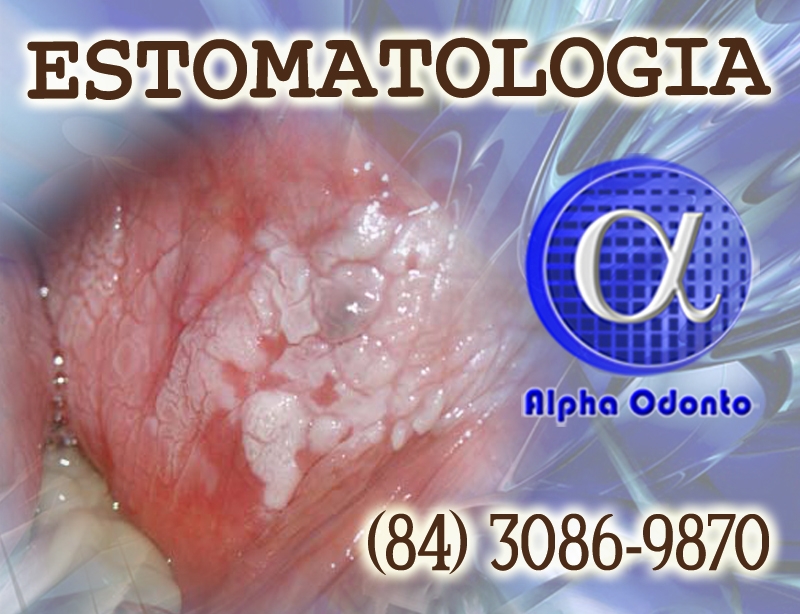 ESTOMATOLOGIA ESPECIALIZADA - (84) 3086-9870