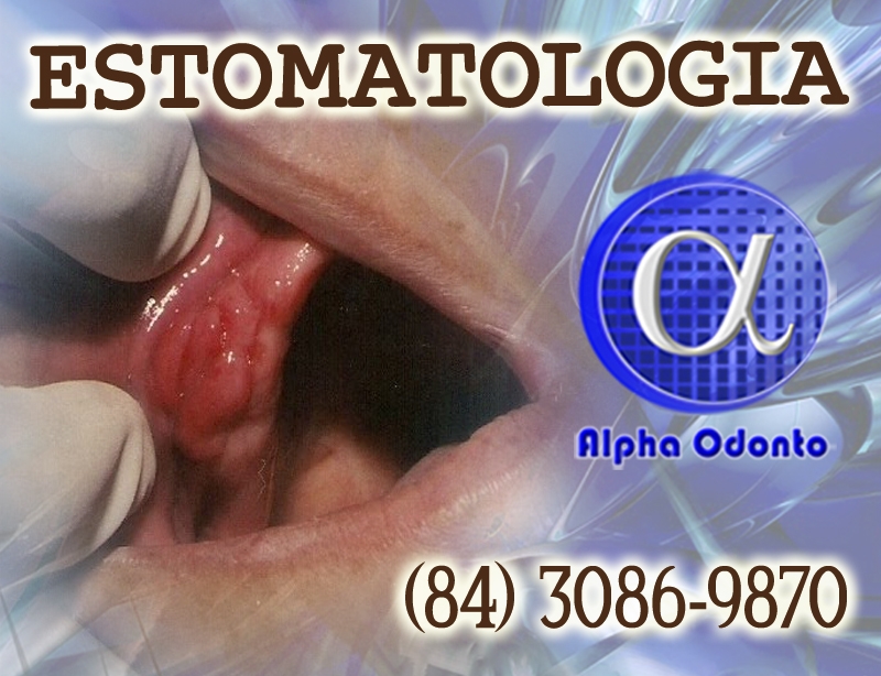 ESTOMATOLOGIA ESPECIALIZADA - (84) 3086-9870